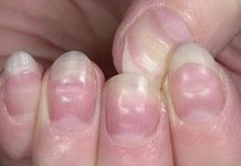 Μάθε αν πέρασες κορονοϊό….από τα νύχια σου!