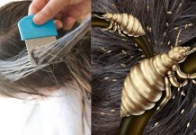 Οι Ψείρες στη ζωή μας!!!