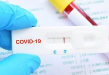 Δωρεάν Rapid test σε επιχειρηματίες και ελεύθερους επαγγελματίες.