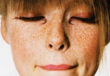 Ρυτίδες και Καφέ κηλίδες: Καταπολέμησε τες!!!