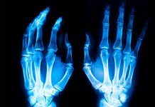 Δύσκολη η ώρα όταν τραυματιστείς. Τραυματισμός